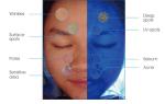 For Cosmetic Doctor Professional Skin Analysis Facial Analyzer 3D Face Analyzer