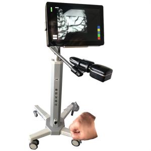 Wholesale Medical Portable Vein Locator Device Spider Vein Removal Machine Imaging Depth &lt; 10mm from china suppliers