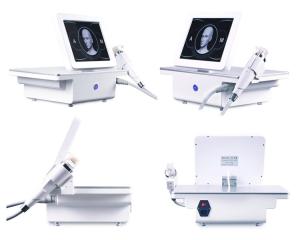 Wholesale 10MHz To 12 MHz Microneedling Machine Scar Stretch Marks Acne Wrinkle Removal from china suppliers