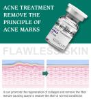 Pure Plant Pimple Clear Serum Whitening Treatment Mesotherapy For Acne Scars