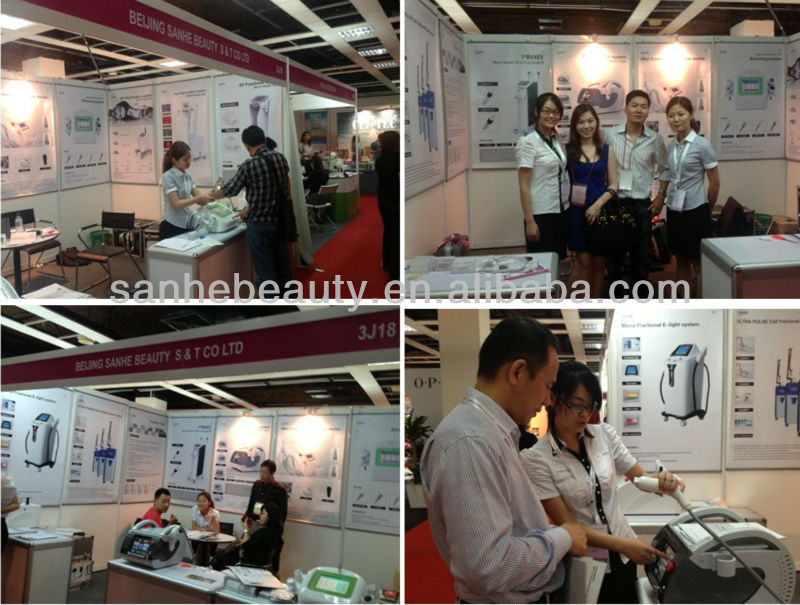 nd yag laser tattoo removal medical laser nd yag equipment