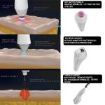 ABS Stainless Steel Cold Jet Plasma Pen Desktop Type For Acne Removal