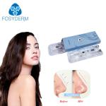 Hyaluronic Acid Filler Hyaluronic Acid Injection Gel Filler For Lip Cheek And