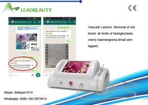 Wholesale Promotions!!!spider vein removal machine Wholesale Ce Approval Rbs Vascular Removal from china suppliers