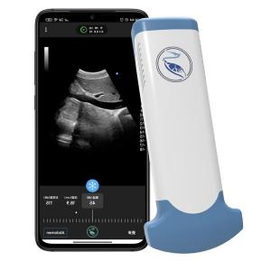 China Emergency Medicine MPEG-4 Handheld Ultrasound Scanner For Clinical Diagnostic Use on sale