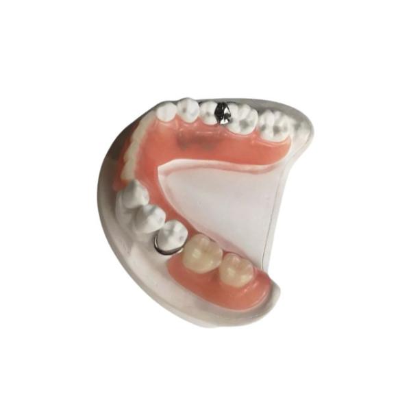 3D Printed Zirconia Dental Crown Quality Assurance Custom Made Removable