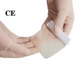Odorless Soft Hydrocolloid Wound Dressing Emergency Adhesive For Emergency