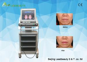 Wholesale Good price Hifu High Intensity Ultrasound Face Lift Machine with 1.5mm, 3.0mm, 4.5mm and 13mm from china suppliers