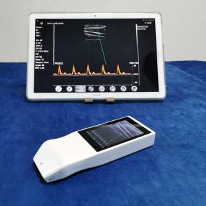 Wholesale Wireless Ultrasound Tranducer Android Color Doppler Ultrasound Probe Wireless Charging from china suppliers