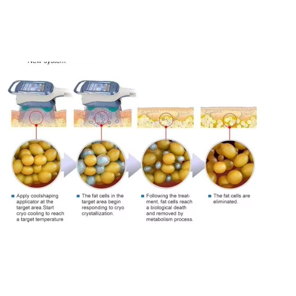 360 5MHz Cryo Fat Freezing Slimming Rf Cavitation Laser Cellulite Reduction Machine