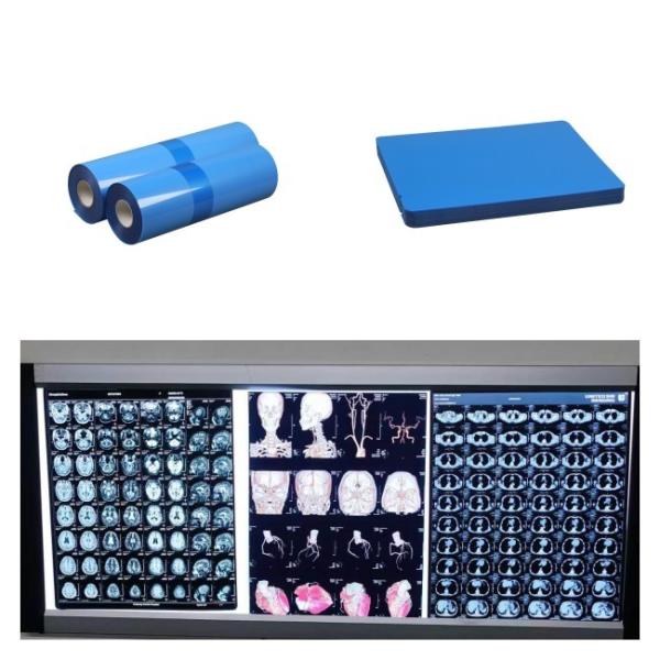 Medical Inkjet X Ray Films For CT MRI DR CR Image Output Compatible With HP