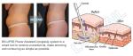 Power Assisted Surgical Vacuum Liposuction Cavitation Machine For Thighs / Arms