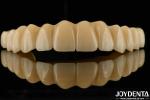 Dental Solution Ti-Base Zirconia Hybrid Bridge High Biocompatibility Natural