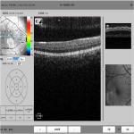 3D Optical Coherence Tomography Equipment High Resolution