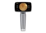 Portable HFC Digital Fundus Camera Ophthalmic Equipment