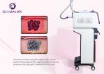Professional Picosecond Laser Tattoo Removal Machine Pulse Energy Up To 800mj
