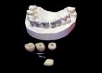 Polished Surface Dental Implant Screw Retained Crown For Tooth Replacement