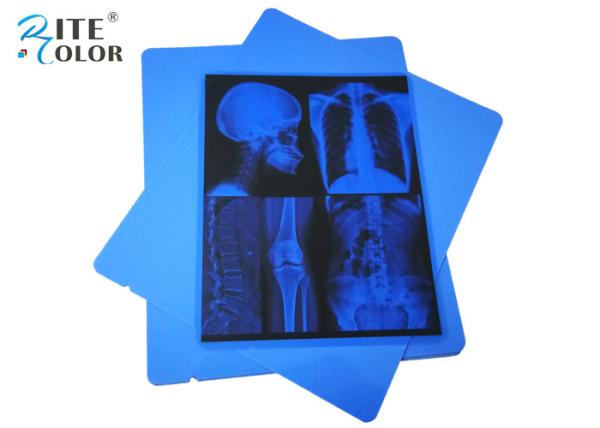 Low Fog A4 Blue PET Dry Pigment Inkjet 210 Micron Medical X Ray Film Eco