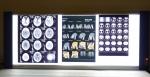 Double Sided Fuji Digital X Ray Film