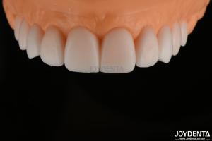 Wholesale Smooth Replicated Diagnostic Wax Up FDA , Full Arch Teeth Wax Up Highly Accurate from china suppliers