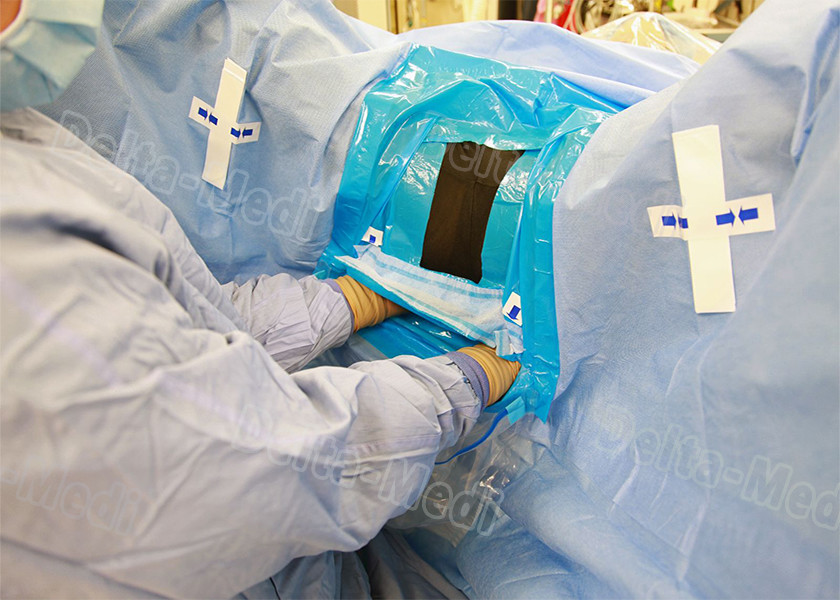 TUR Surgical Disposable Sterile Urology Drape / Lithotomy Drape With Aperture / Pouch