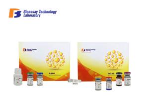 Wholesale 96 Wells Human SHBG Sandwich Immunosorbent Assay Kit Highly Sensitive With Oem Service from china suppliers