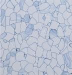 2mm-4mm Glue Down Vinyl Flooring ESD PVC Commercial Hospital Flooring