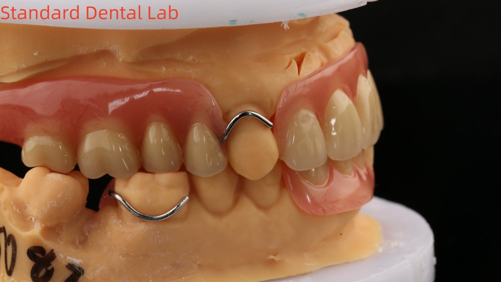 Heat Cured Ivoclar Partial Acrylic Denture Dental Lab High Accuracy with 3D print model