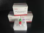 SARS-CoV-2 RT PCR Test Kits Nucleic Acid Throat Swab Sample Fluorescence