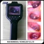 LCD Video Otoscope digital Flexible ENT Endoscope Types With Natural White 3.5