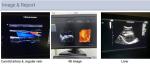 2D 3D 4D Echocardiography Cardiac Trolley Echo Color Doppler Ultrasound Machine
