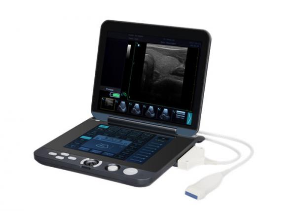 Quality 128 Images Permanent Storage Portable Digital Ultrasound Scanner with 12 Inch LED Screen for sale