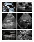 Ultrasound Scan Equipment Portable Ultrasound Scanner Ipad Ultrasound Machine