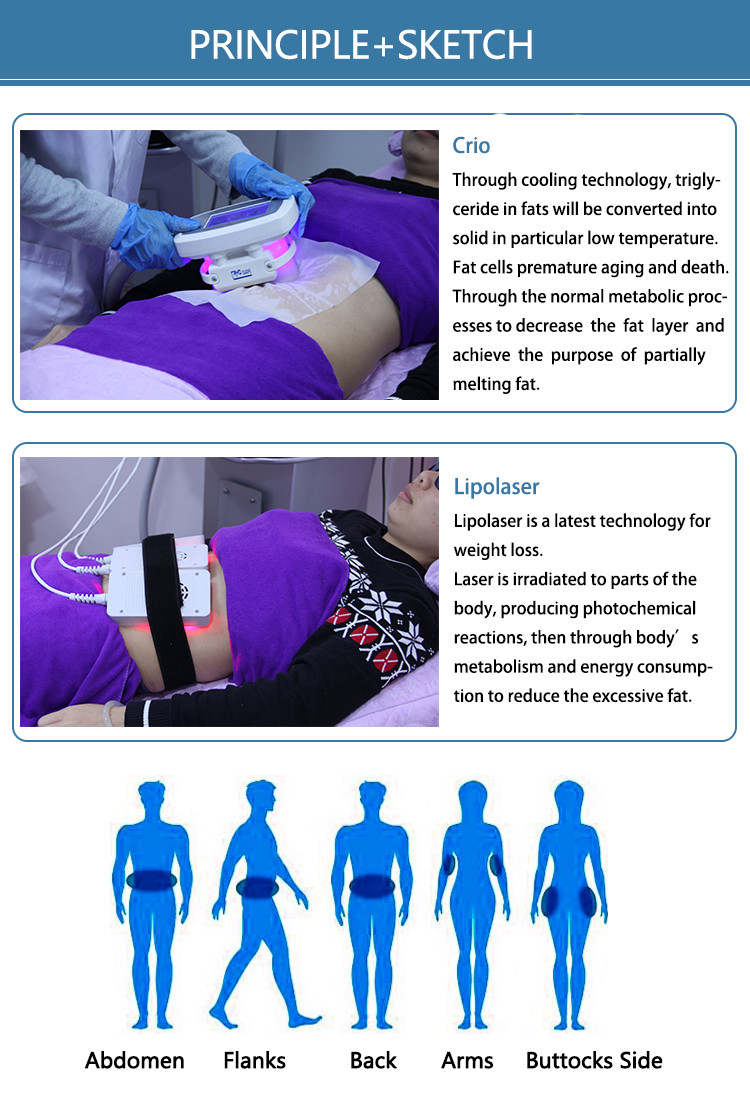 LF-233 2 in 1 Portable cryolipolysis lipo laser freezing cryo Fat reduce Device