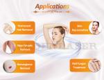 755 Nm Alexandrite Laser Hair Removal Long Pulsed Nd Yag Laser Machine 1064nm