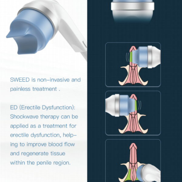 Professional SW7 Android Smart Focused ESWT Shockwave Machine for Deep Tissue Pain Relief Recovery