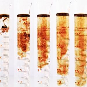 Spraying Microbial Inoculant Organic Fertilizer Bio Compost Trace Element