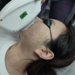 Skin Rejuvenation 7mm Spot Size IPL SHR Elight Machine With TEC Sapphire -25 °C