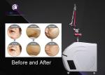 1-10HZ ND YAG Laser Machine Skin Rejuvenation 2-10mm Spot Diameter