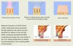 Hot!!! Diode laser for hair removal 808nm beauty machine depilight for spa /