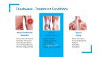 Revitalize Your Pain Management Strategy with Shockwave Therapy Machine 6