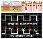 SHR Golden manufacturer super hair removal ipl shr laser/ shr ipl