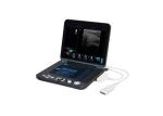 9.7 Inch Touch Screen Control Panel Battery Veterinary Portable Ultrasound USB