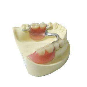 Wholesale Healthy Materials Denture Dental Lab Removable Partial Dentures custom made from china suppliers