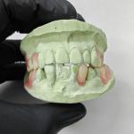 High Precision Thermoplastic Resin , Flexible Partial Denture Base Resin