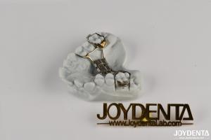 Wholesale Long Lasting Custom Retainer For Teeth , Orthodontic Retainer Replacement One Size from china suppliers