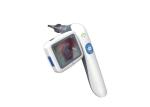 Portable Video Otoscope Resolution 640 X 480 3 Inch LCD Monitor Digital