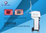 Pigment Melasma Removal Portable Laser Tattoo Removal Machine 1064 755 532nm