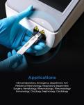 D2D IVD D-Dimer Rapid Quantitative Test Kit IFA Colloidal Gold POCT Diagnostic