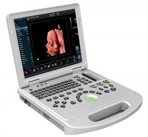 Wholesale CE 3D 4D 5D Portable Color Doppler Ultrasound Machine Scanner OEM from china suppliers